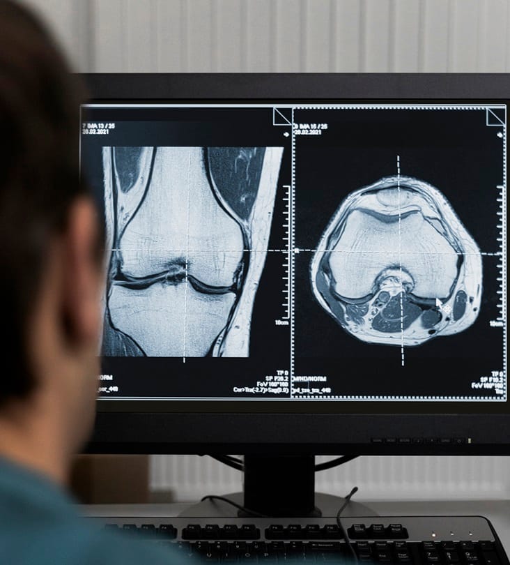 Tumor is de medische term voor zwelling of gezwel.